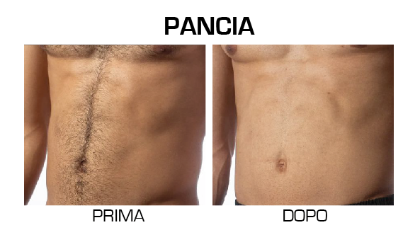 pancia